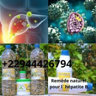 Remede naturel pour l hepatite b 320x320