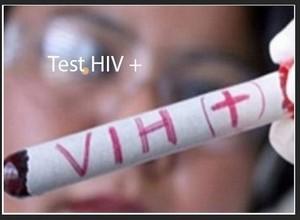 Test hiv positif Charge Virale Traitement