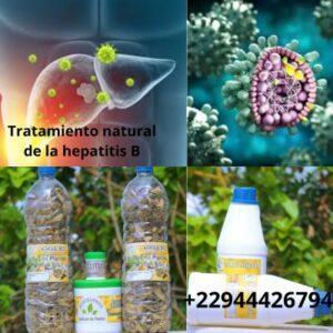 Tratamiento natural de la hepatitis b 300x300